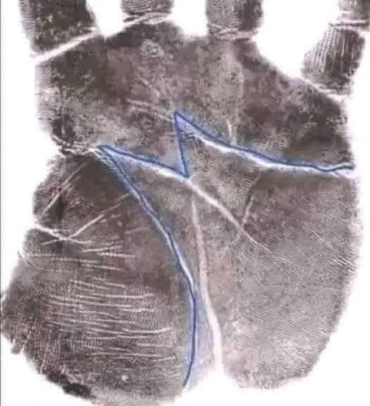 THE MEANING OF THE LETTER M ON THE HAND