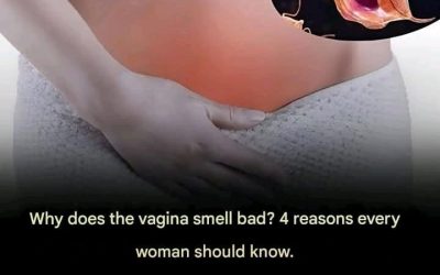 Why does the vagina smell bad? 4 reasons every woman should know.