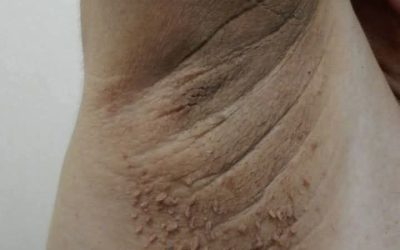 These are the first symptoms of cr…See more